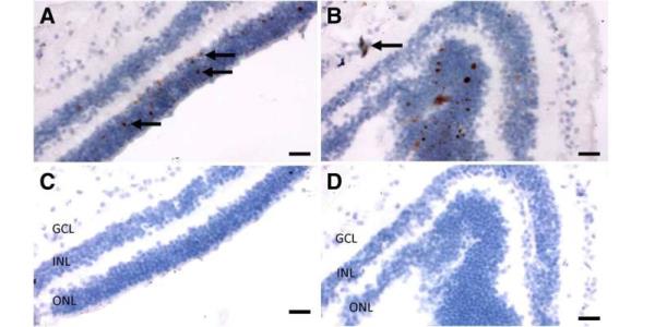 SARS-CoV-2 infects ocular tissue, but surprisingly, inflammation was absent in the eyes of patients who died from COVID-19